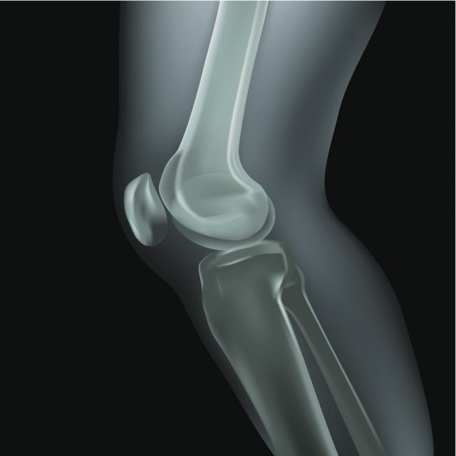 X-Ray